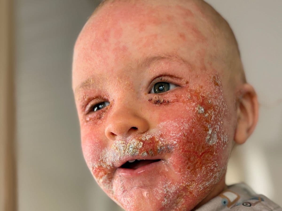 Help us get Charlie to Bali